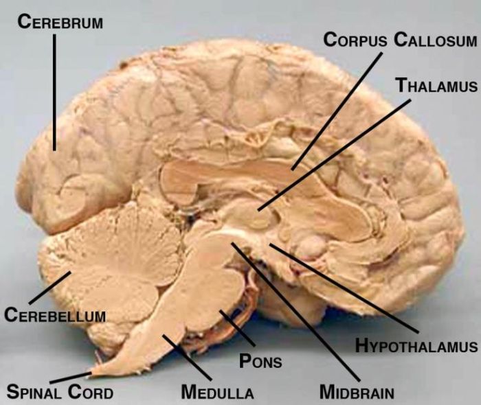 Sagittal brain sheep section anatomical mid structures features