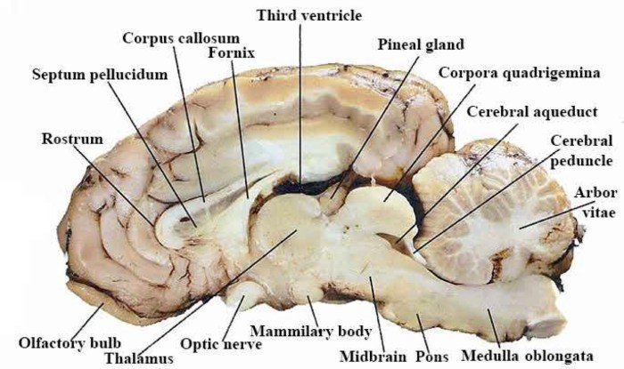 Sheep brain midsagittal view labeled