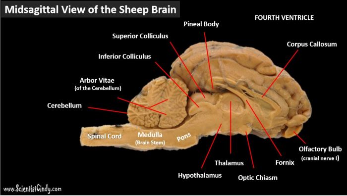 Sheep brain midsagittal view labeled