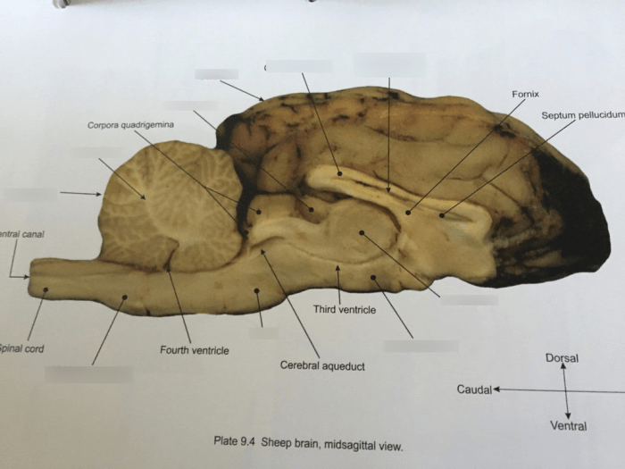 Brain sheep labeled anatomy internal lobe bio201 occipital savalli unlabeled frontal human choose board labs